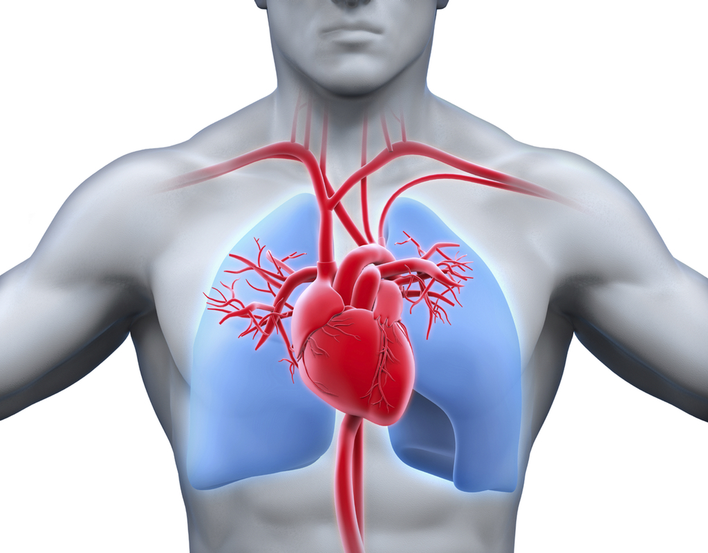 Pleurisy