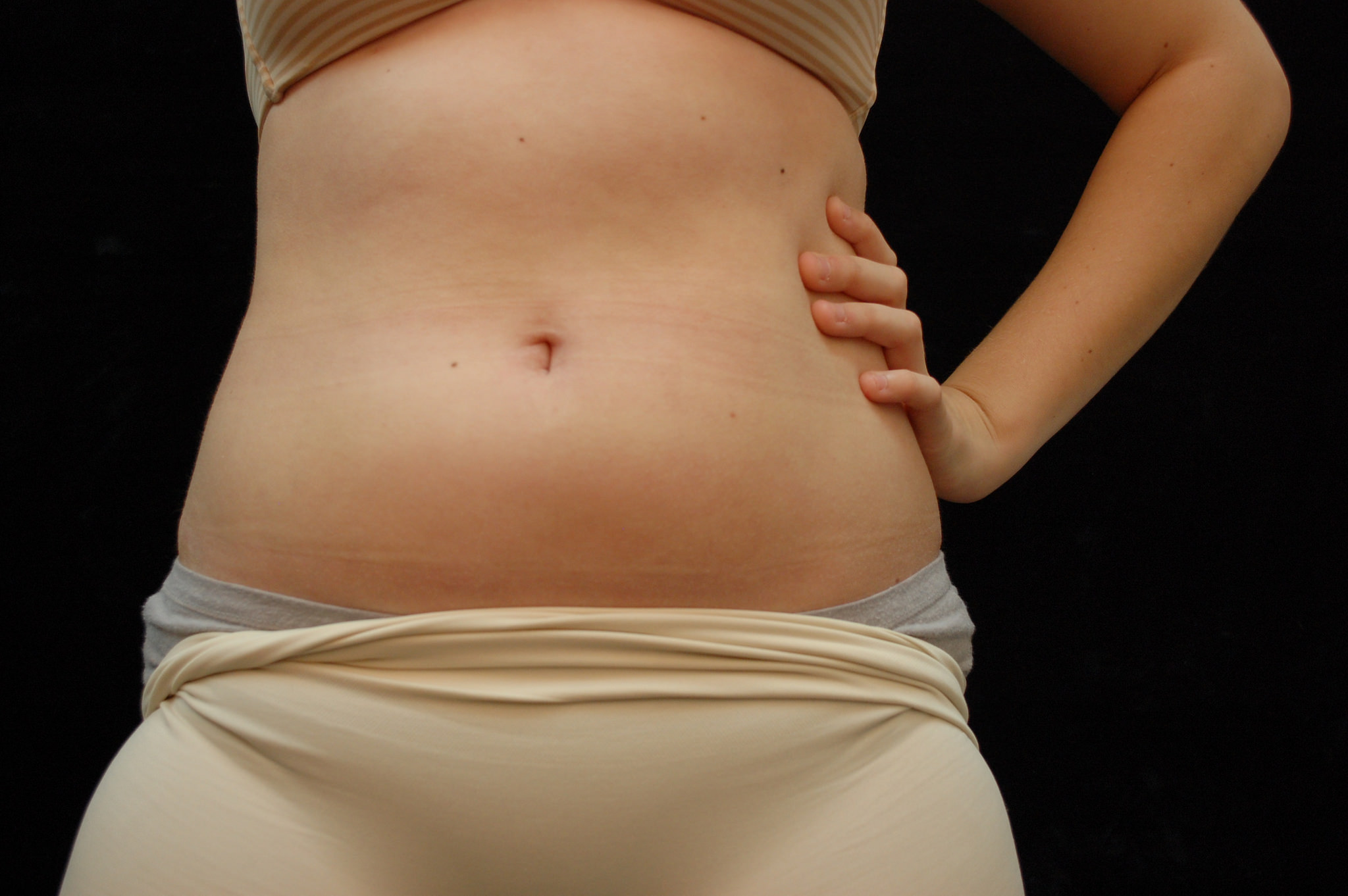 Abdominal inflammation