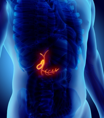 Cholecystitis acute