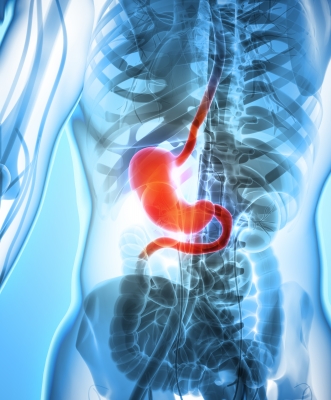 Heartburn chronic