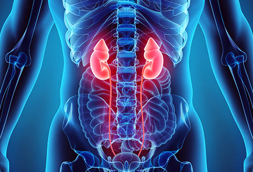 Uremia (Kidney, renal failure)