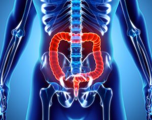 Proctitis (inflammation of anus)