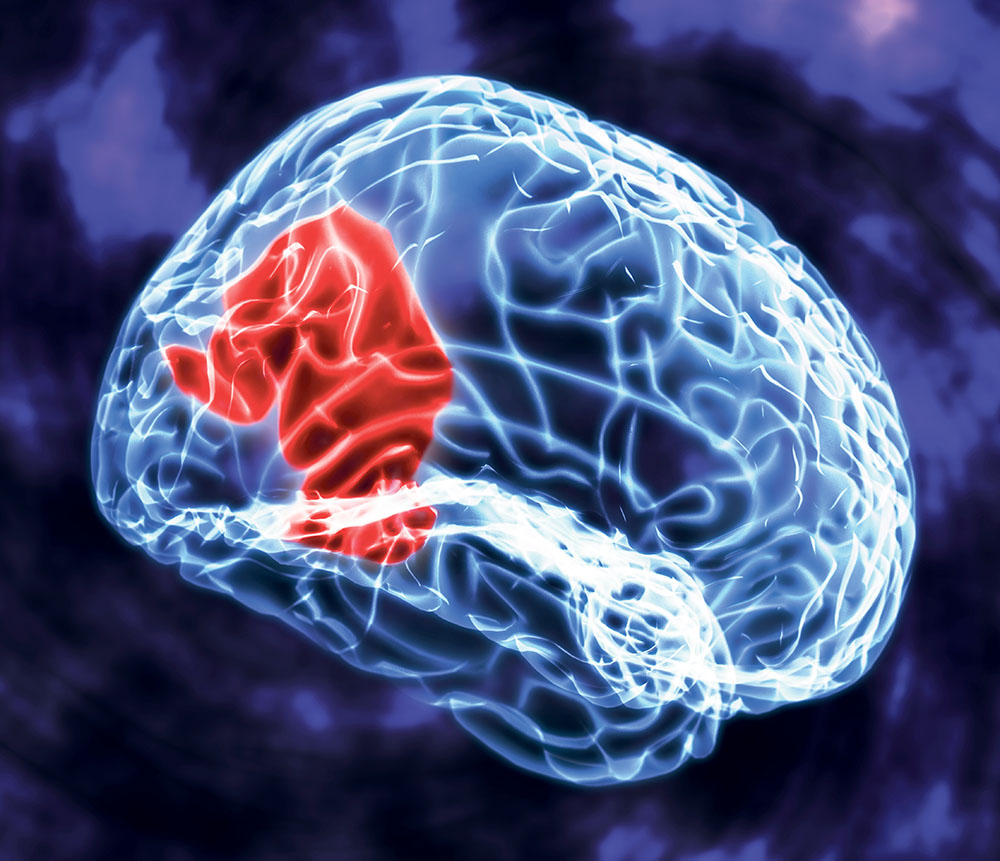 Pineal gland stimulation