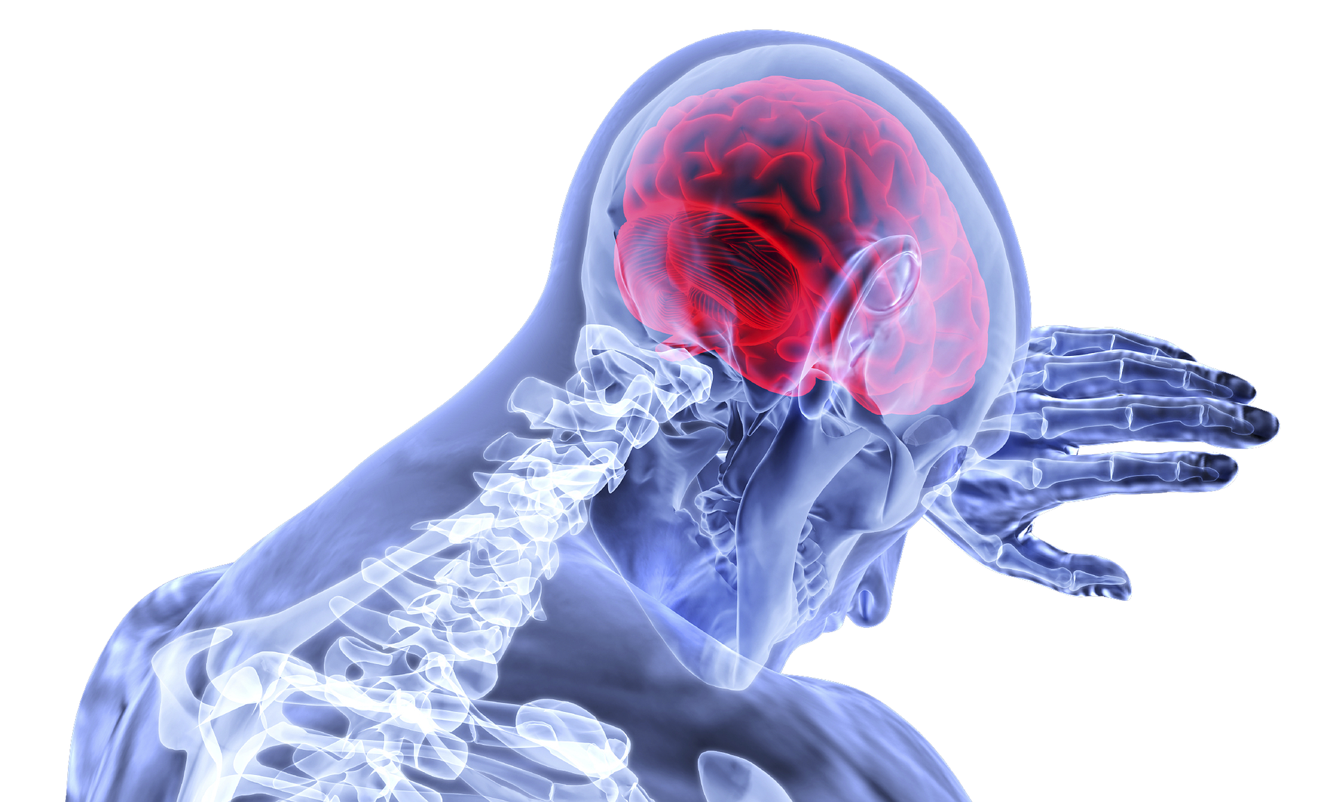 Cerebral palsy