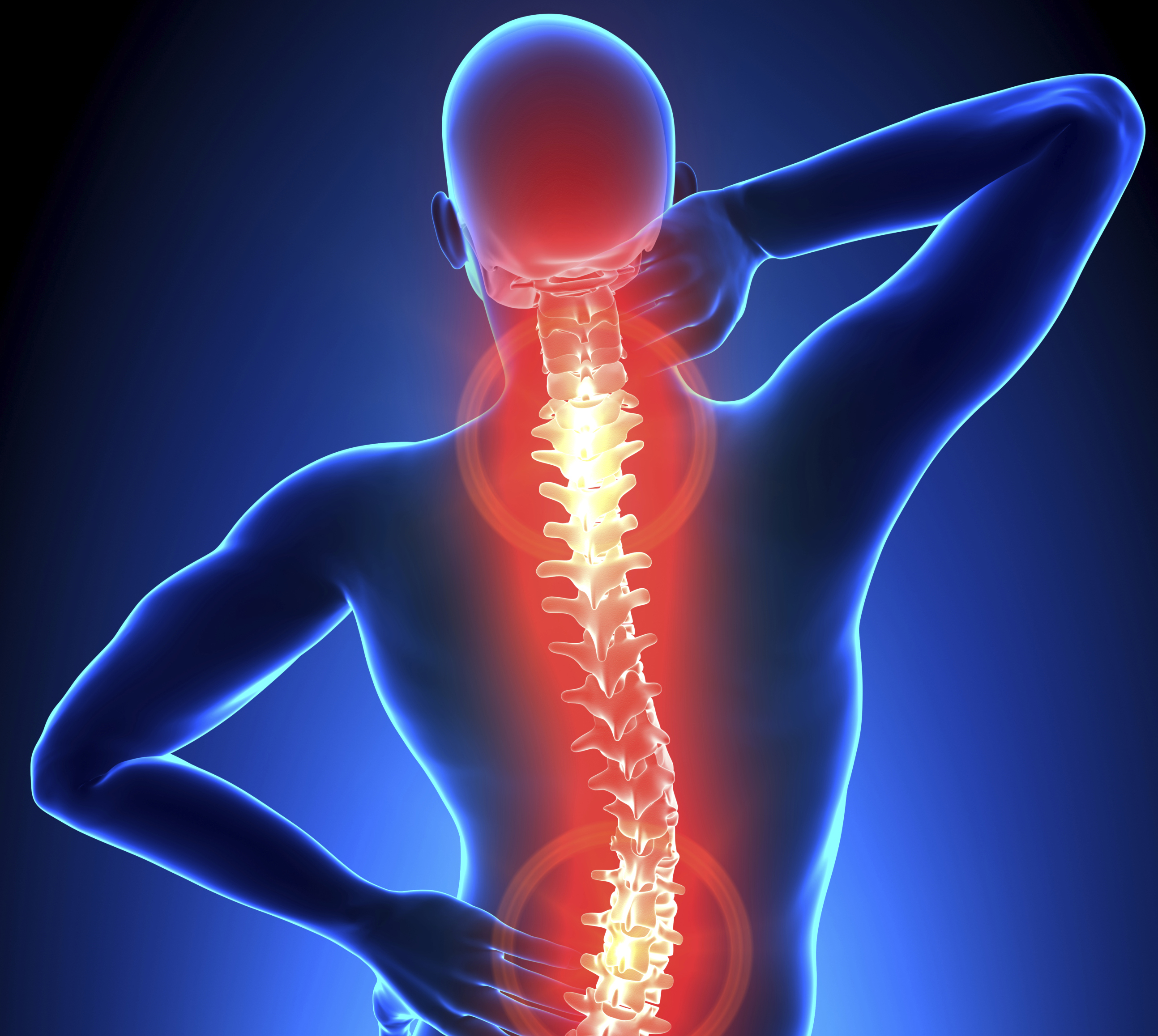 Arthritis