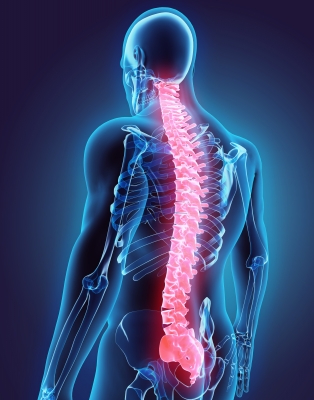 Sciatica