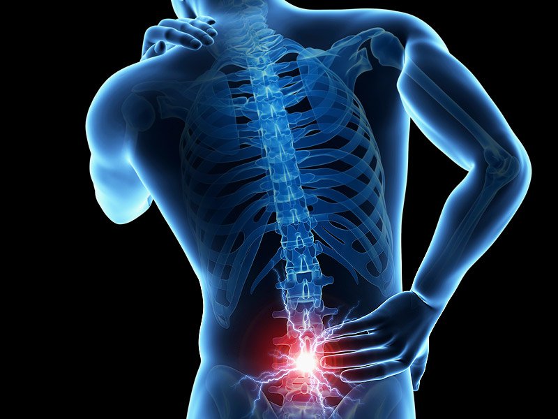 Backache chronic lower