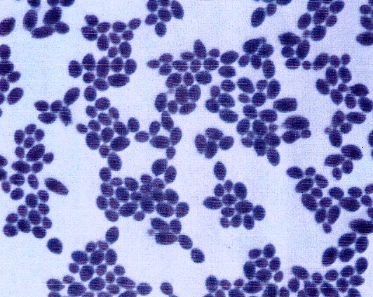 Candida