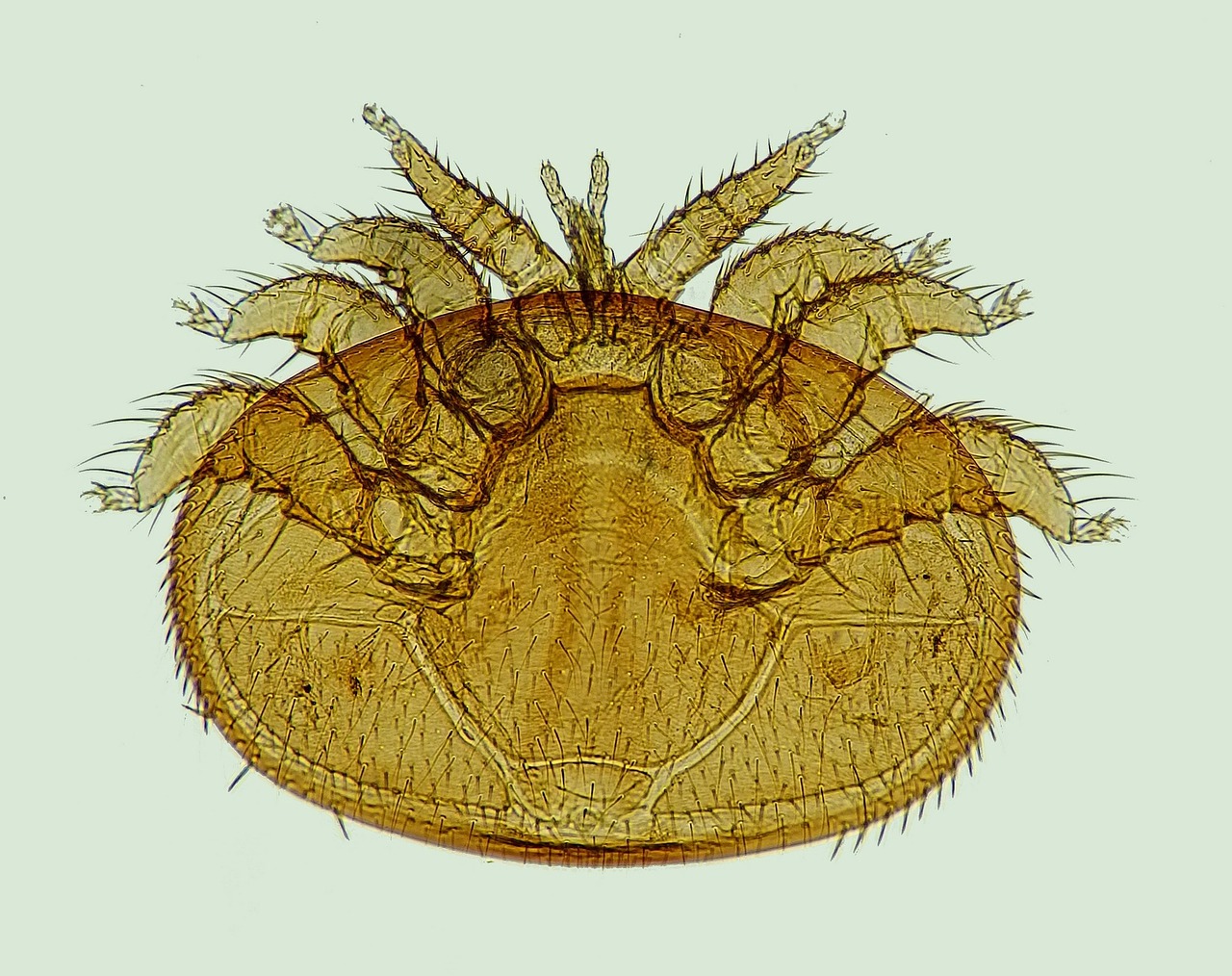 Rickettsia